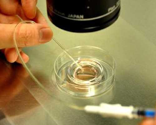 单身可以到格鲁吉亚试管吗